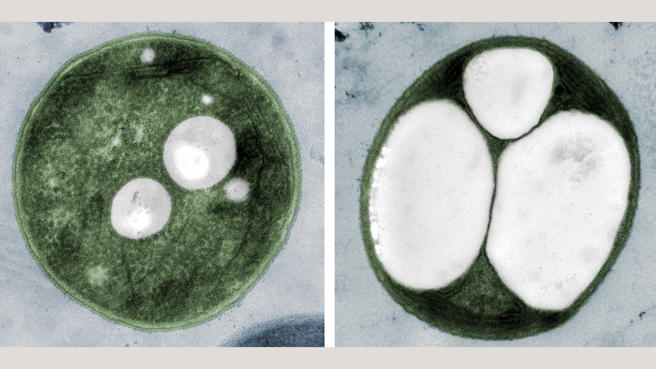 Bacteria forming PHB plastic